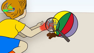 التوكسوبلازما