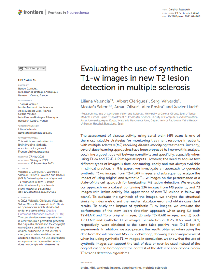 Evaluating the use of synthetic T1-w images in new T2 lesion detection in multiple sclerosis