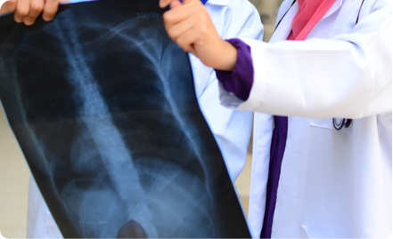 Department of Chest Diseases