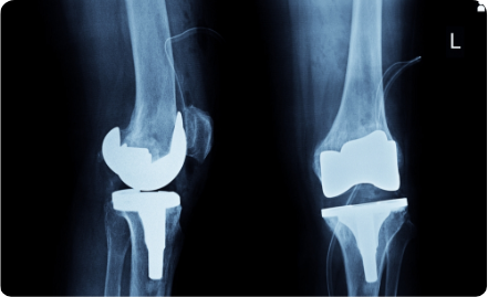 Department of Orthopedic Surgery and Traumatology 