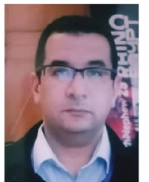 فريق طبي بقسم جراحة الأنف والاذن والحنجرة بمستشفيات جامعة أسيوط ينجح في استئصال ورم بالغدة النكافية ممتد الي قاع الجمجمة من خلال جرح صغير بديلا عن كسر الفك السفلي للوصول إلى الورم