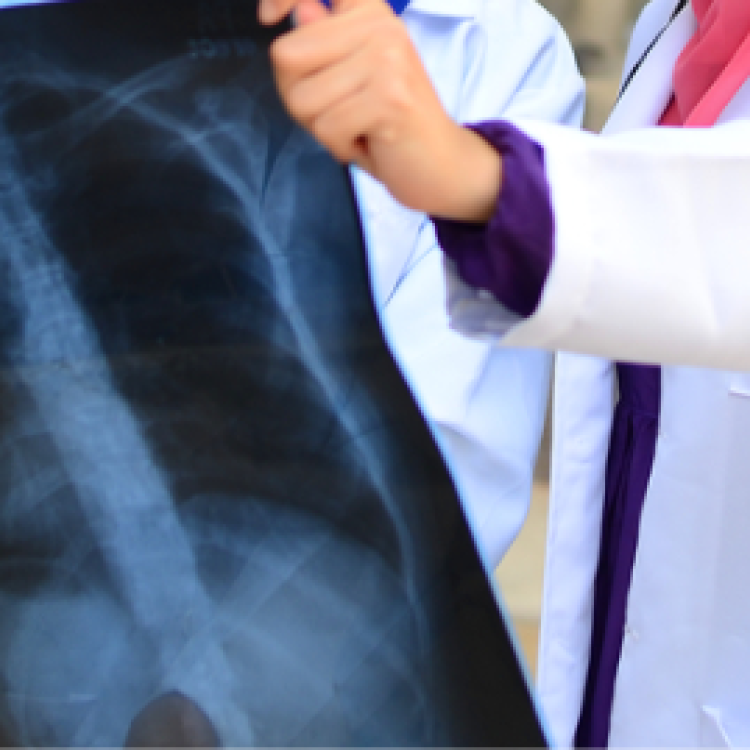 Department of Chest Diseases