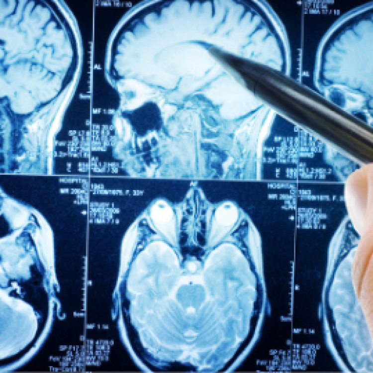 Neurology and Psychiatry