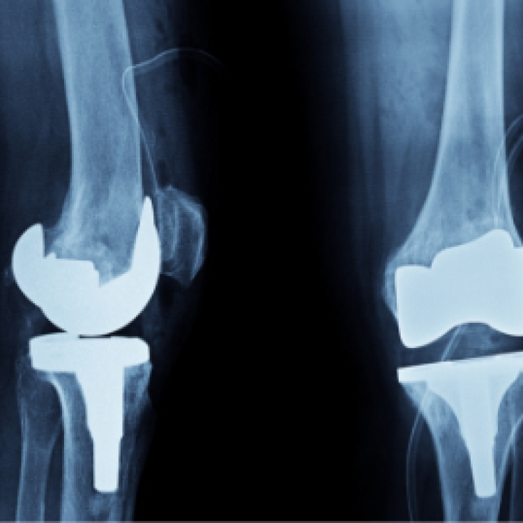 Department of Orthopedic Surgery and Traumatology 